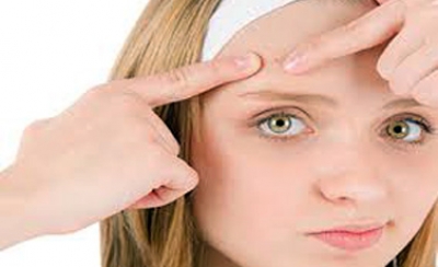 10 روش  برای درمان جوش‌های سرسفید صورت (قسمت دوم)